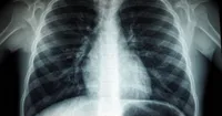 img of Incident Report: Adversarial Attack on AI Diagnostic System at NHS Trust