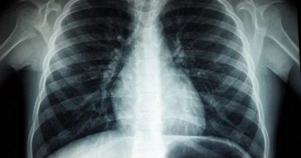 img of Incident Report: Adversarial Attack on AI Diagnostic System at NHS Trust